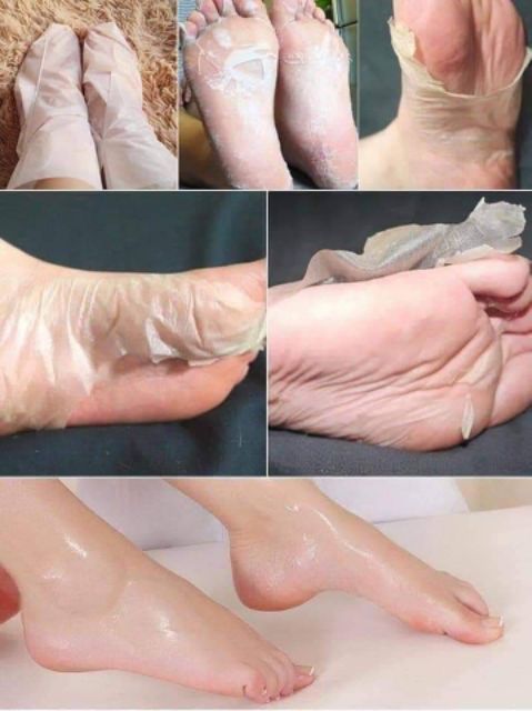 Mặt nạ ủ chân Baby Foot Hàn Quốc