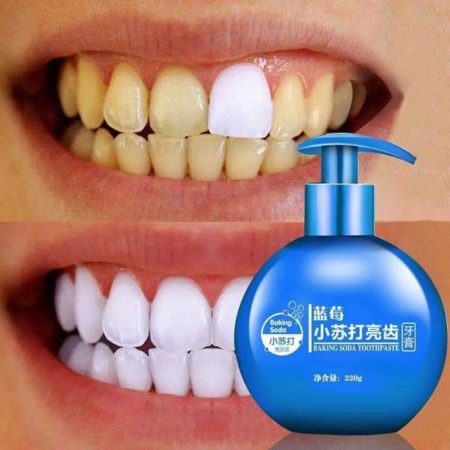 Kem đáng răng baking soda