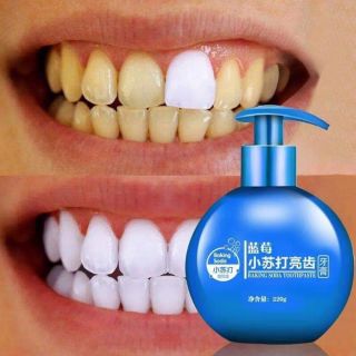 Kem đáng răng baking soda