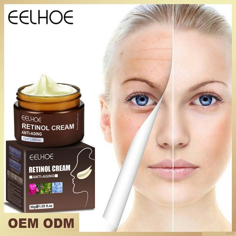 Kem Retinol Dưỡng Ẩm Chống Lão Hóa Nuôi Dưỡng Da Mịn Màng 30g