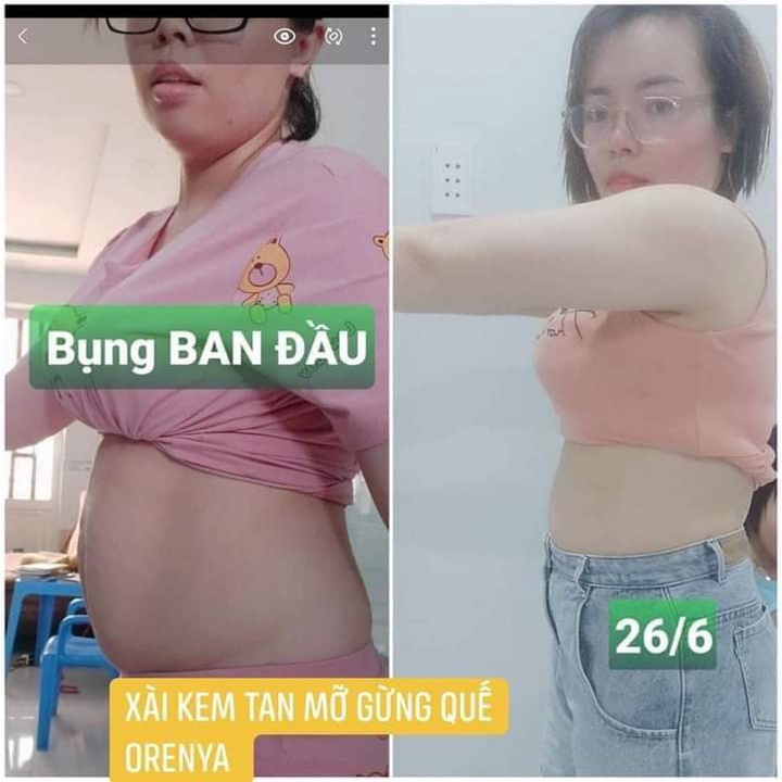 KEM TAN MỠ GỪNG QUẾ ORENYA  _KEM MÁT XA  MỞ BỤNG TAY CHÂN