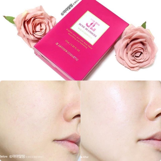 [SẴN, ĐỦ BILL] Mặt nạ JAYJUN Hoa hồng dưỡng trắng cấp ẩm sâu Rose Blossom hộp 10 miếng 25ml