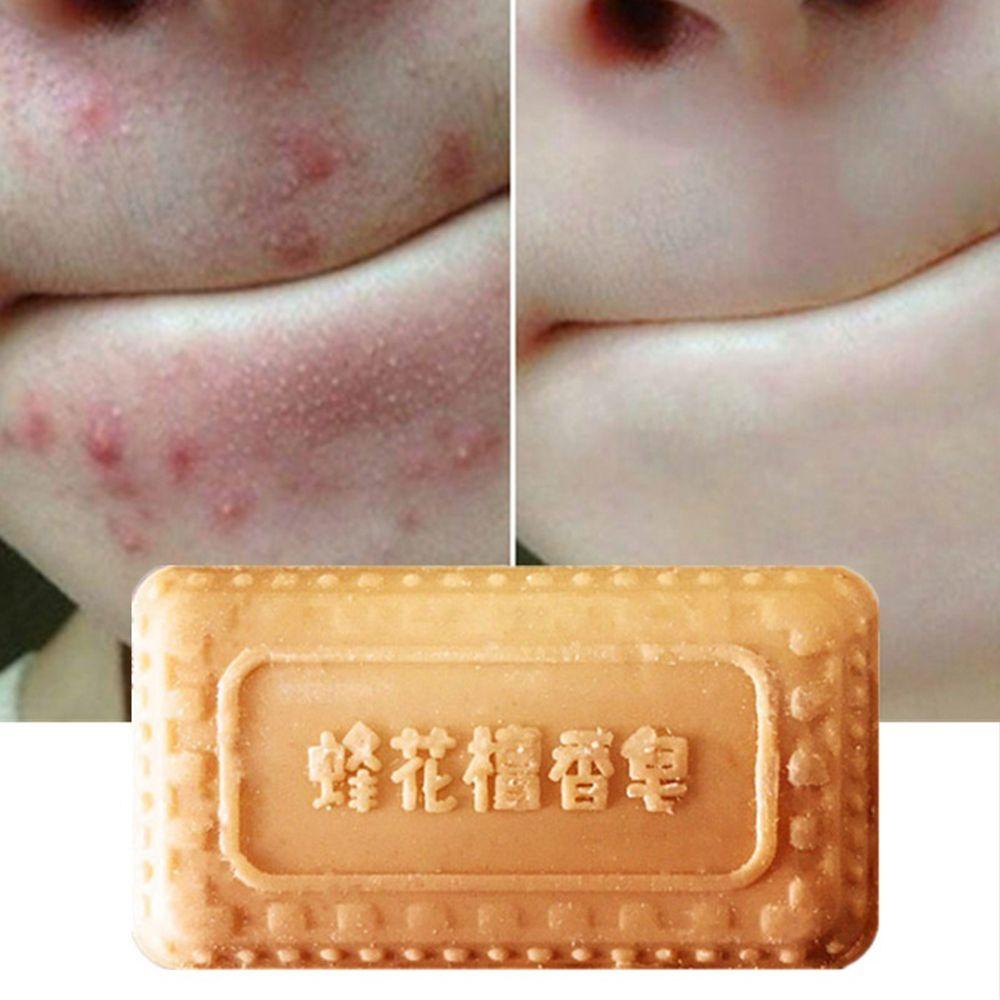 SOFTNESS Xà Phòng Tắm Bằng Gỗ Đàn Hương Tự Nhiên Giúp Loại Bỏ Mụn Đầu Đen