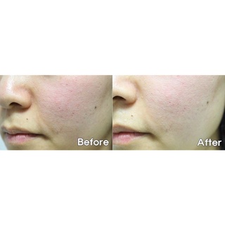 [AUTH 100%] Tinh Chất Dưỡng Trắng Da - Graymelin Yellow Food Serum 50ml