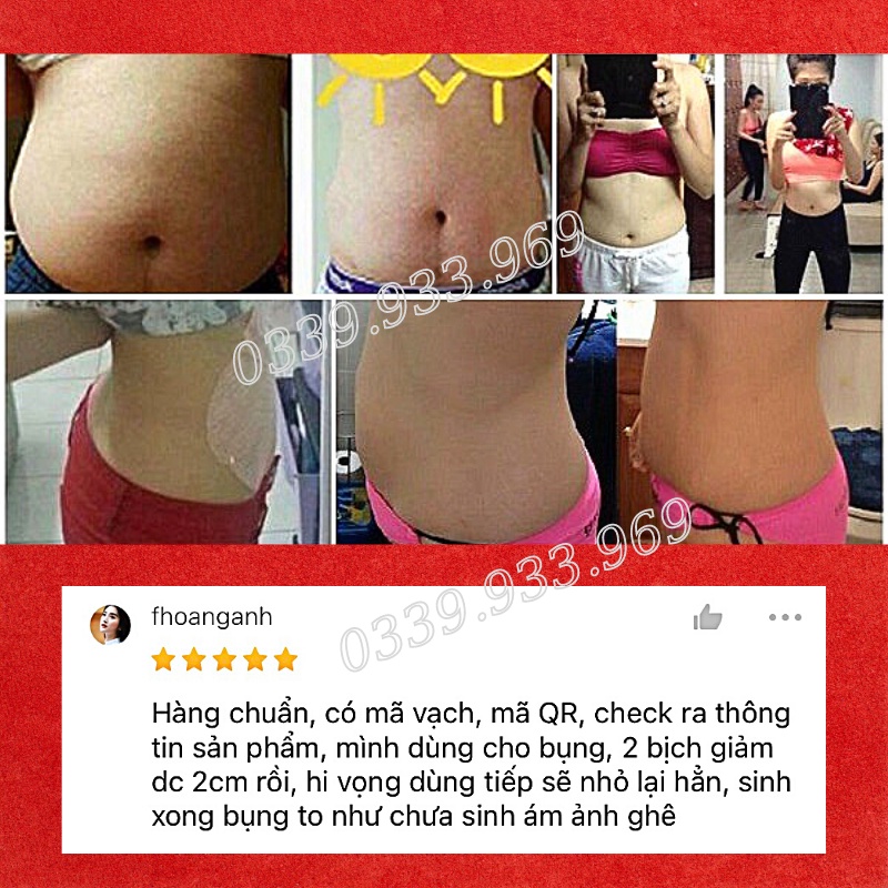 Miếng Dán Tan Mỡ Bụng Kroko Navel Paste - Dán Tan Mỡ Thái Lan - Giảm Mỡ Bụng, Bắp Tay, Bắp Chân