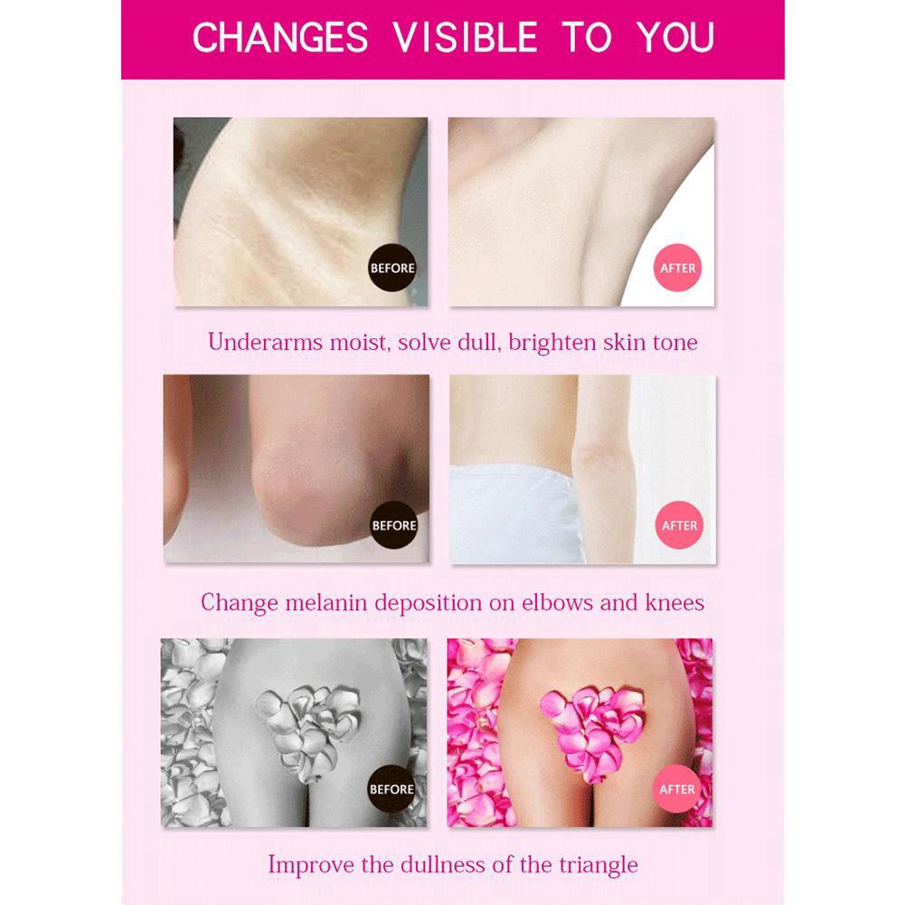 Kem dưỡng trắng và xóa mờ vết thâm cho vùng da dưới cánh tay hiệu quả