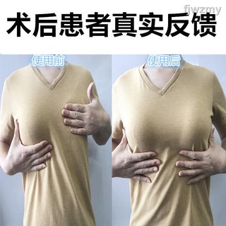 Ngực Giả Y Tế Bằng Silicon