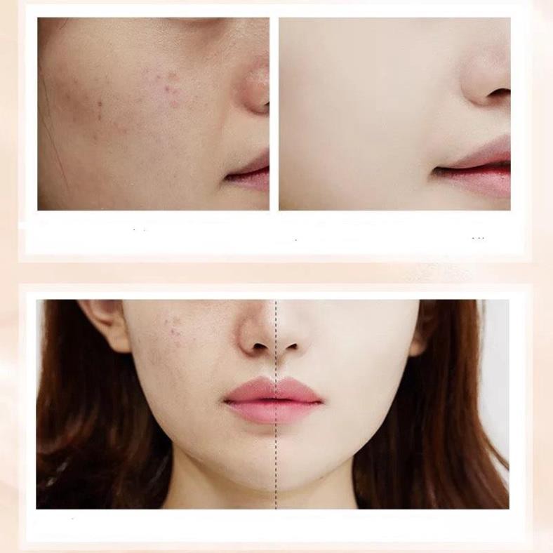 Hot!! Kem nền BB Cream Perfect Cover Images | BigBuy360 - bigbuy360.vn