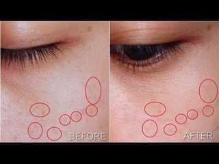 [sẵn] Bút chấm Anti Pickment Eucerin 5ml