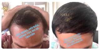 Tinh dầu bưởi Nare