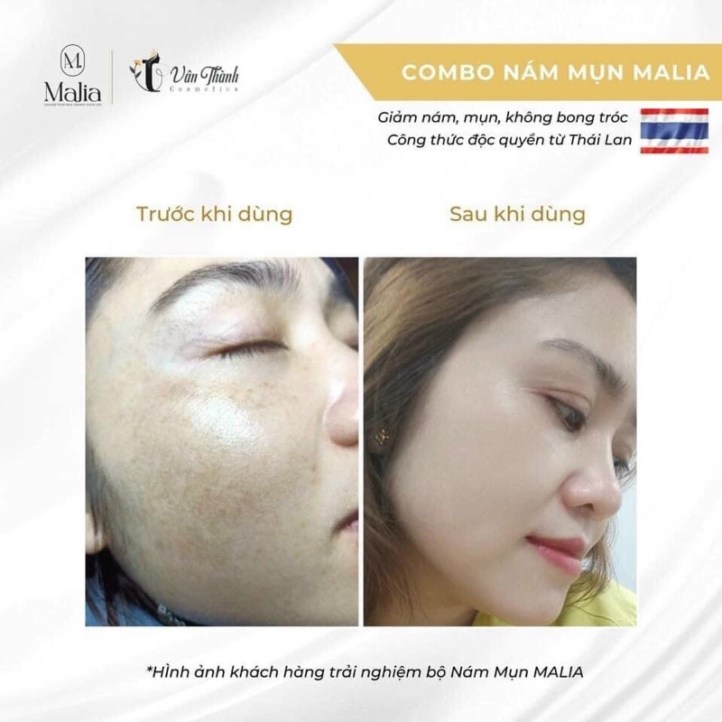 Malia Dưỡng Da Cao Cấp Thái Lan – Malia Melasma Treatment & Cleaning Skin mini