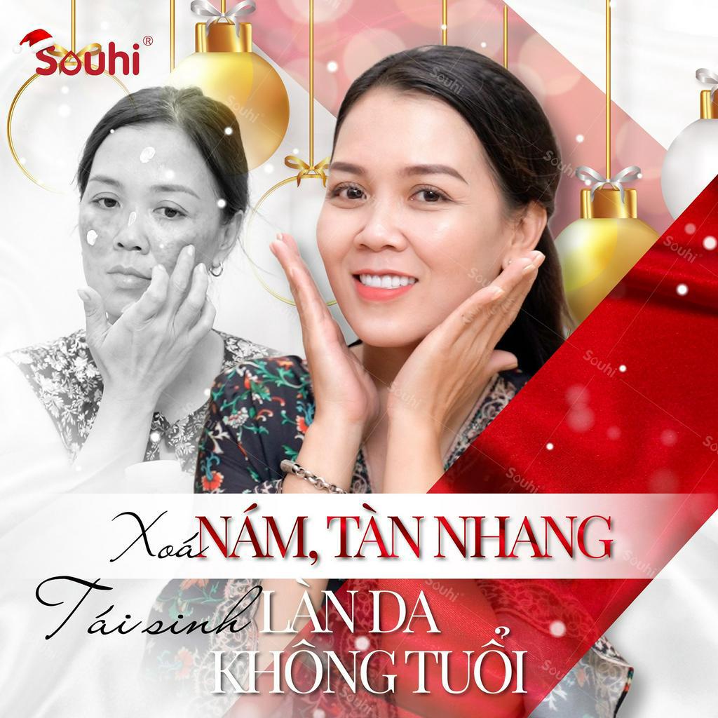 [DATE 09-12/2023] Bộ tr! nám, chống lão hoá chứa Niacinamide, Arbutin, Hoa cúc &amp; Ốc sên SOUHI (Việt Nam)