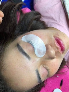 Dán mắt dưới bảo vệ mắt