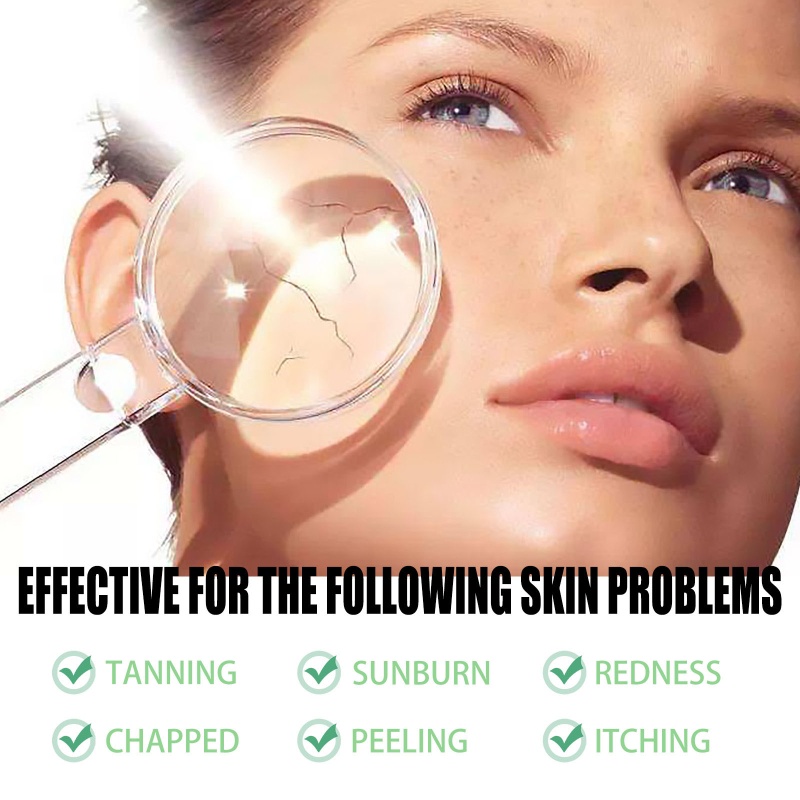 Gel Lô Hội Tăng Tốc Da Cháy Nắng Cho Nữ