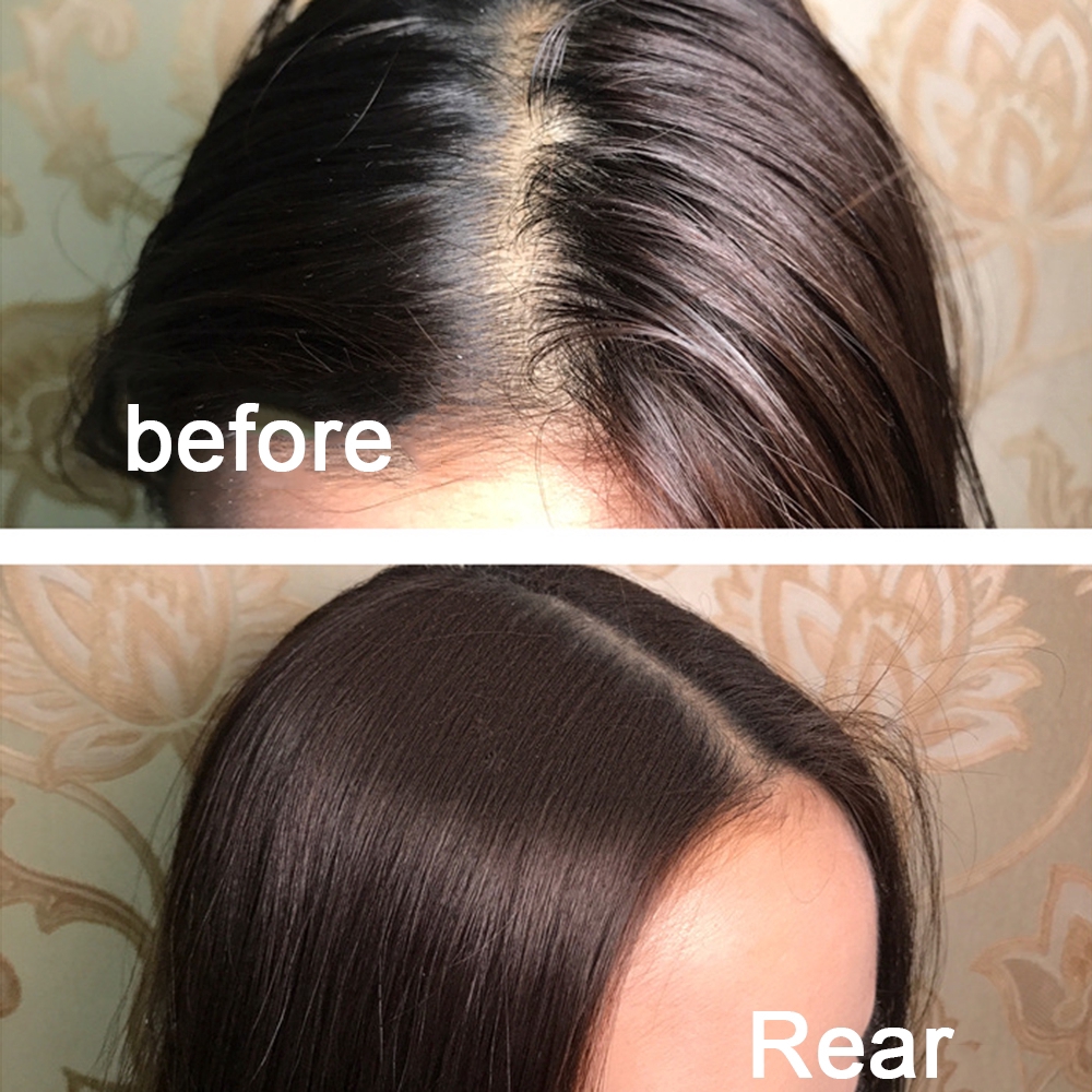 Phấn phủ thấm hút dầu chống bết nhờn dành cho tóc