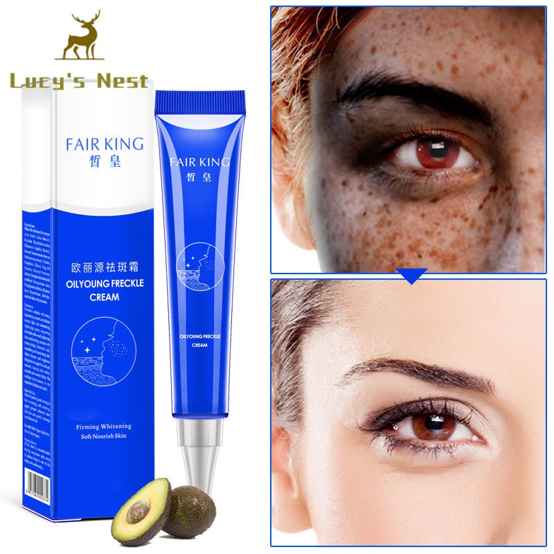 (Hàng Mới Về) Kem Trị Tàn Nhang Làm Trắng Da 20g