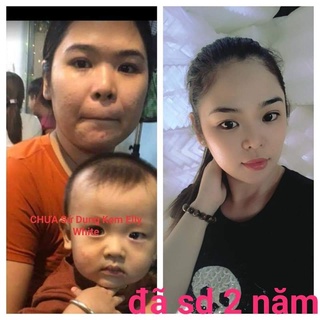 kem dưỡng trắng da