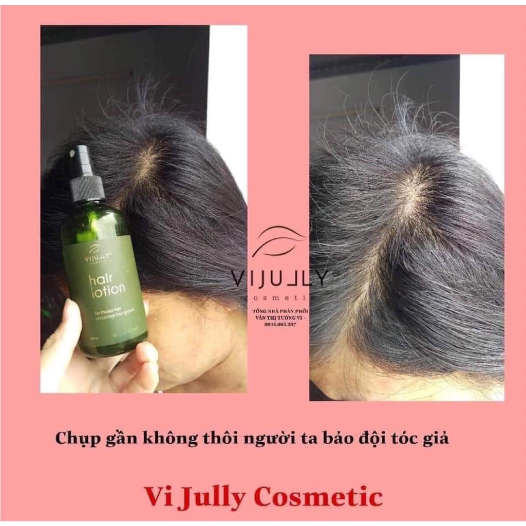Tinh Dầu Dưởi Dưỡng Tóc ViJully, Giảm Rụng Tóc, Làm Dài Tóc Phục Hồi Hư Tổn, Dung Tích 100ml