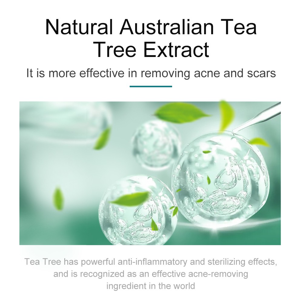 Kem tinh chất tràm trà SKIN EVER 30g cải thiện da mặt bị mụn | BigBuy360 - bigbuy360.vn