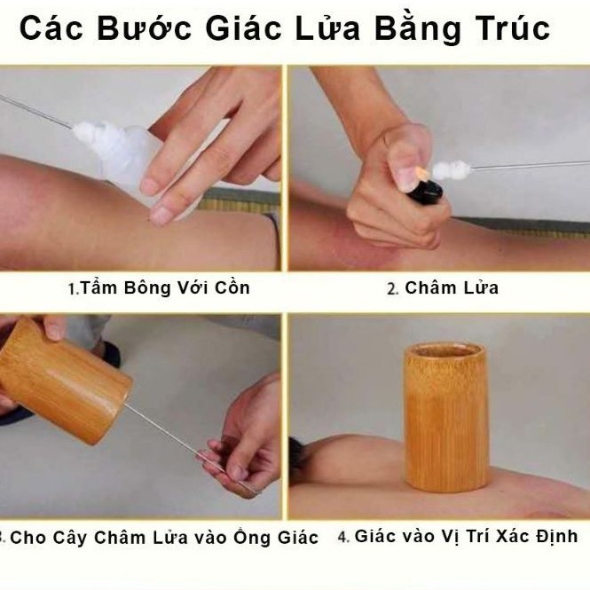 Ống giác hơi trúc các cỡ(3ống)