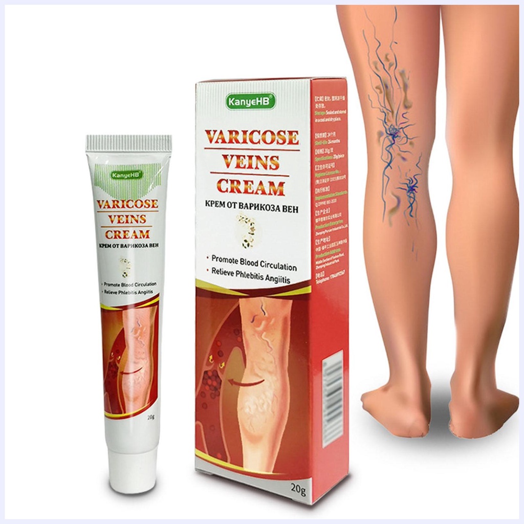 Kem Hỗ Trợ Giảm Giãn Tĩnh Mạch Chống Giãn Tĩnh Mạch Chân 20g