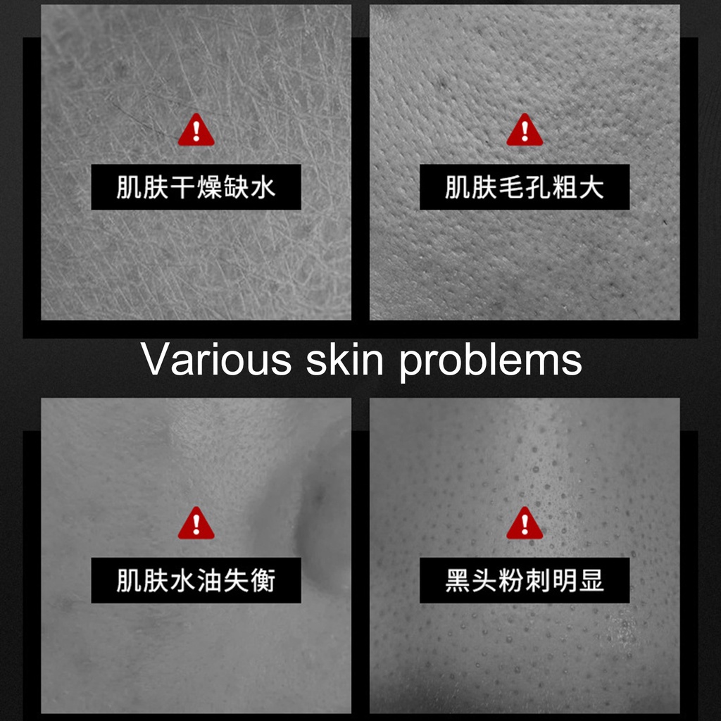 (Hàng Mới Về) Kem Than Tre Lột Mụn Đầu Đen Làm Sạch Sâu 30g Ốp | BigBuy360 - bigbuy360.vn