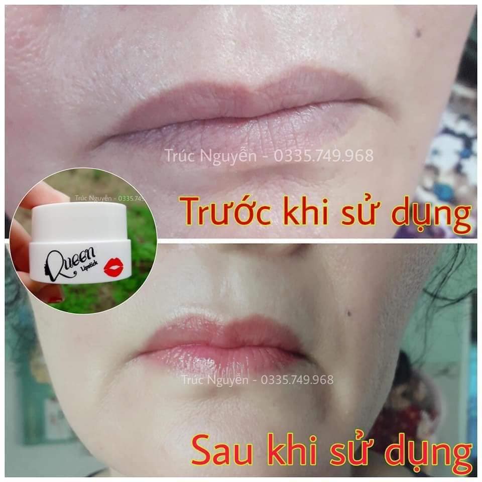 Ủ Hồng Môi, Hồng Ti Queen [TẶNG KÈM BĂNG ĐÔ TAI MÈO]. | BigBuy360 - bigbuy360.vn