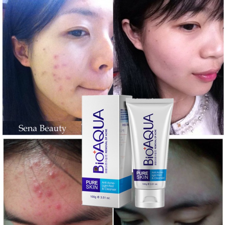 Sữa rửa mặt cho da mụn Bioaqua Pure Skin Anti Acne Cleanser 100G Senabeauty