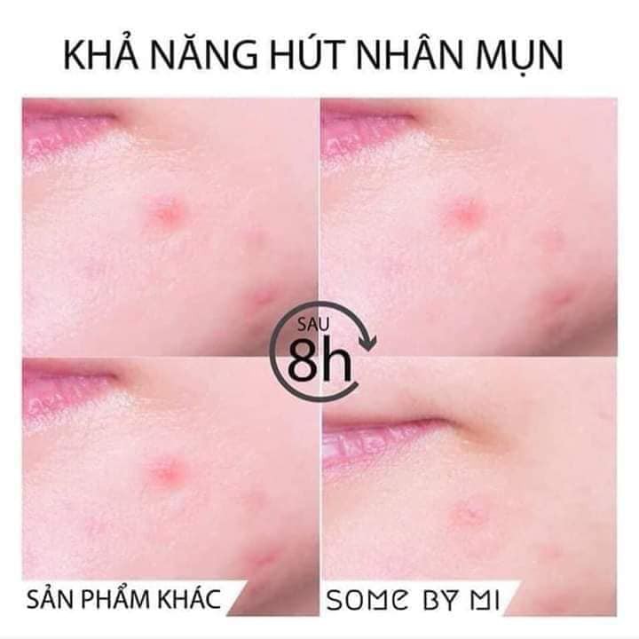 MIẾNG DÁN MỤN SOME BY MI CLEAR SPOT PATCH 18 MIẾNG CHÍNH HÃNG - 4123