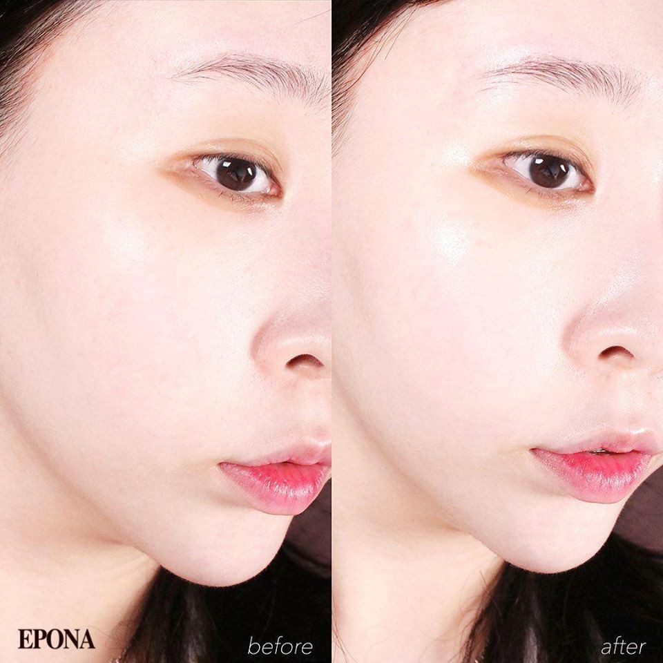 Kem Dưỡng Da Đa Năng Chuyên Sâu Epona All In One Total Skin Care Intensive