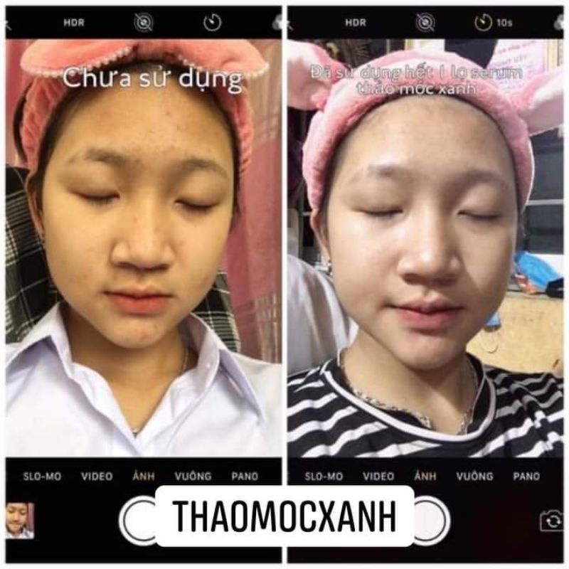 (CHÍNH HÃNG) THẢO MỘC XANH X5 LỌ 5ML | BigBuy360 - bigbuy360.vn