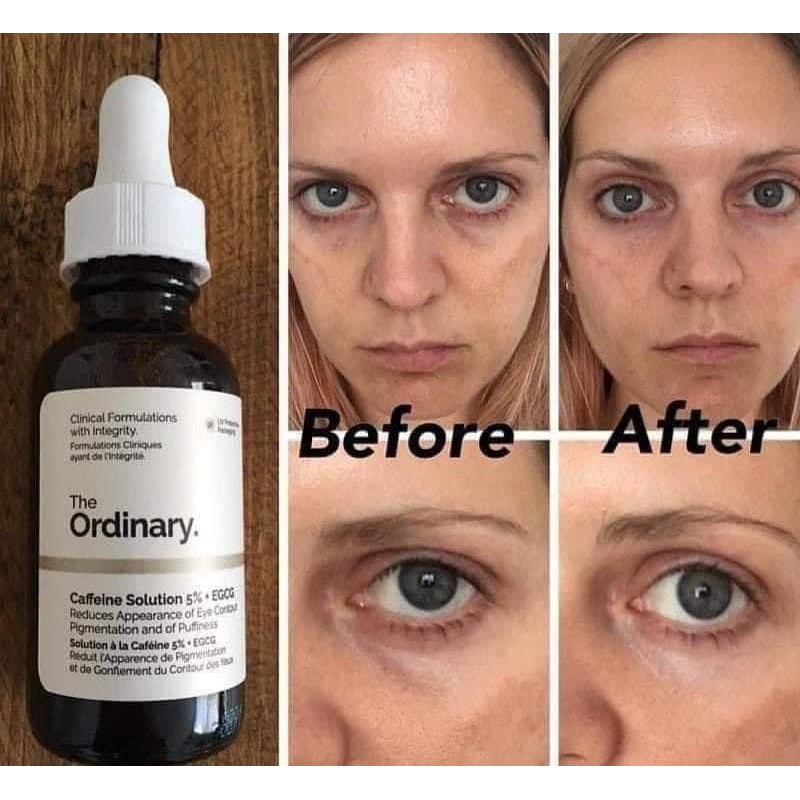 [THE ORDINARY] TINH CHẤT GIẢM QUẦNG THÂM, BỌNG MẮT THE ORDINARY CAFFEIN SOLUTION 5%+ EGCG | BigBuy360 - bigbuy360.vn