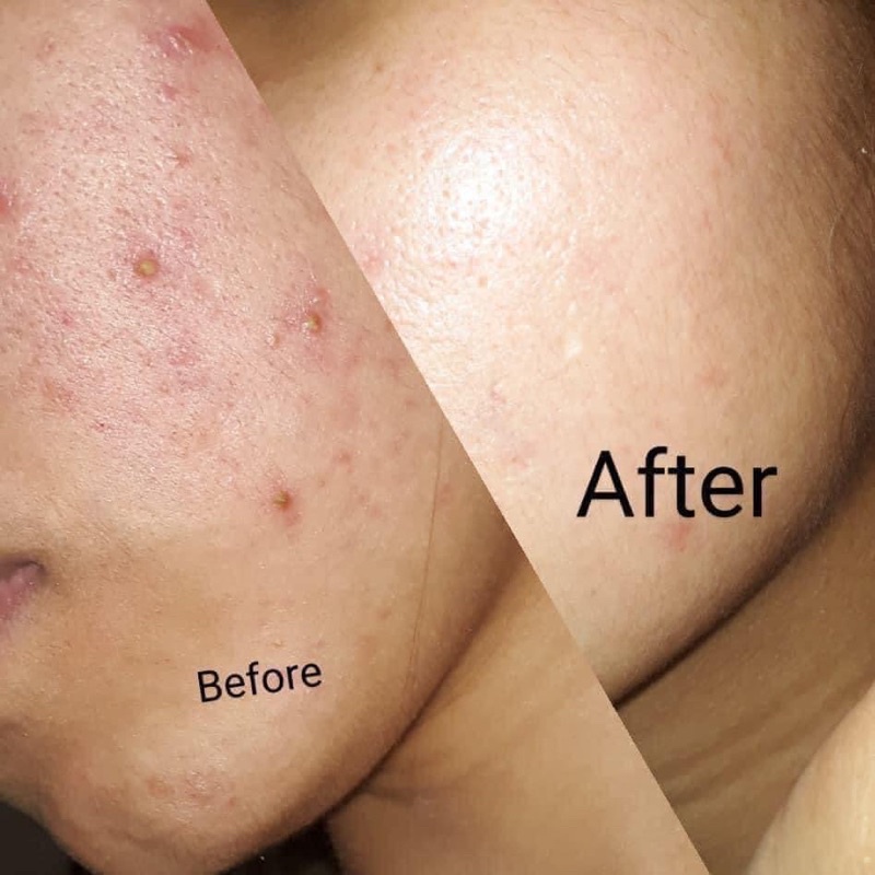 [FREE SHIP] Kem Dưỡng Ngừa Mụn Kiềm Dầu SVR Sebiaclear Mat+