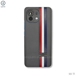 Dán da Xiaomi Mi 11 theo yêu cầu