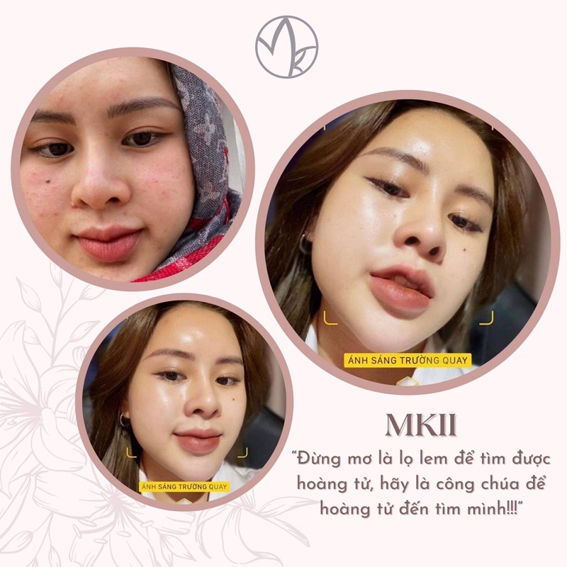 Serum Soothing phục hồi MKII COSMETICS