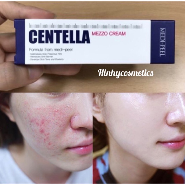 KEM TẾ BÀO GỐC CENTELLA MEDI-PEEL | BigBuy360 - bigbuy360.vn