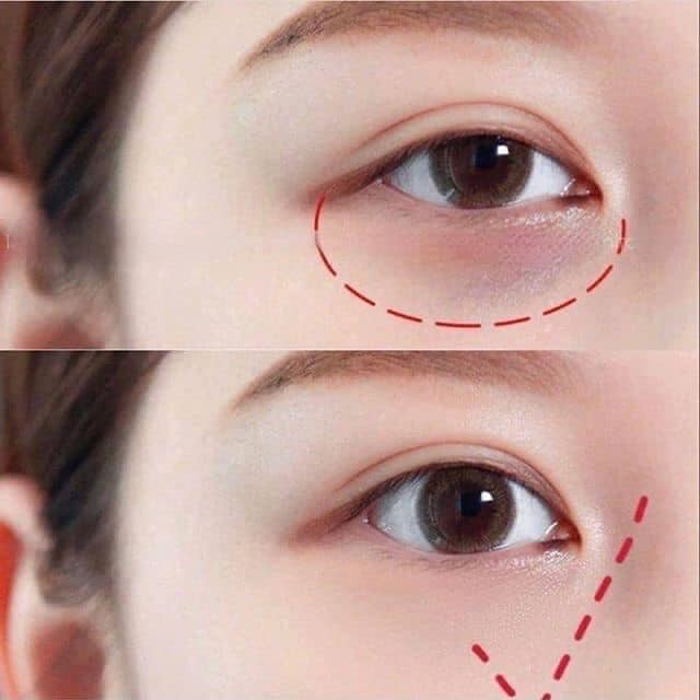 Kem giảm thâm quầng mắt Kumargic Eyes Nhật Bản - NAC BEAUTY