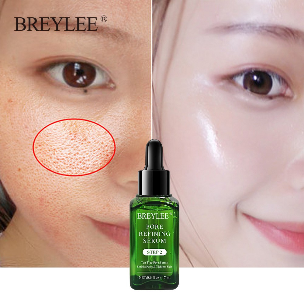 BREYLEE Blackhead Removal Essence 17ml+17ml Shrinking Serum Tighten Pores Deep Cleanse Oil Control Skin Care Set