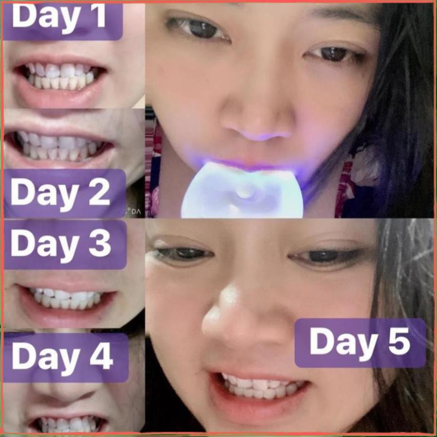 [ Hàng ÚC] Máy làm trắng răng bằng ánh sáng xanh White Glo White Accelerator Blue Light Teeth Whitening System