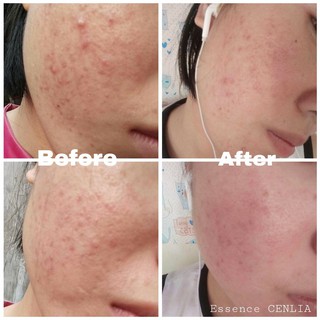 Tinh chất Essence CENLIA
