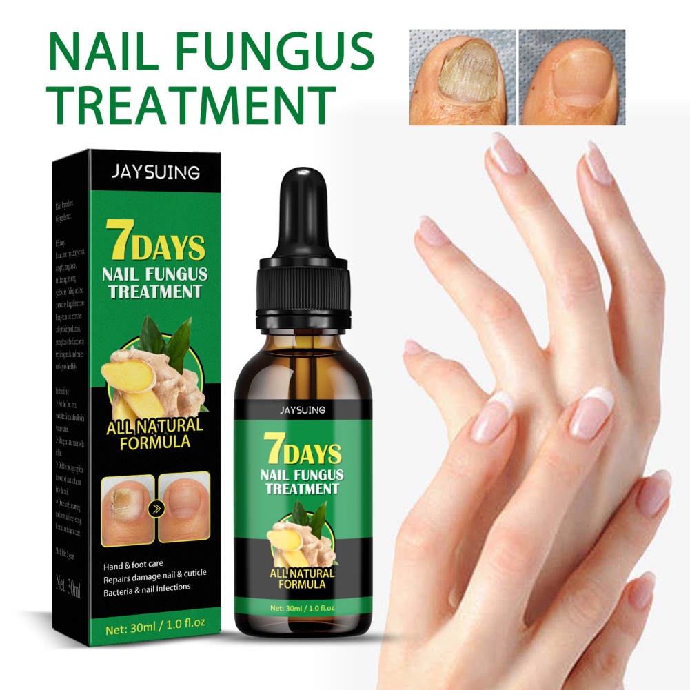 Tinh chất JULYSTAR gừng 7 ngày loại bỏ nấm/ chống nhiễm trùng chăm sóc móng tay/ chân
