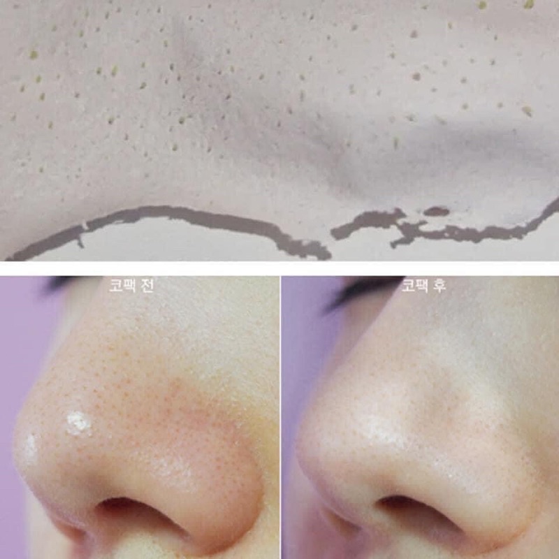 [FREE SHIP] Mặt Nạ Lột Mụn Đầu Đen Mụn Cám The Face Shop 50g