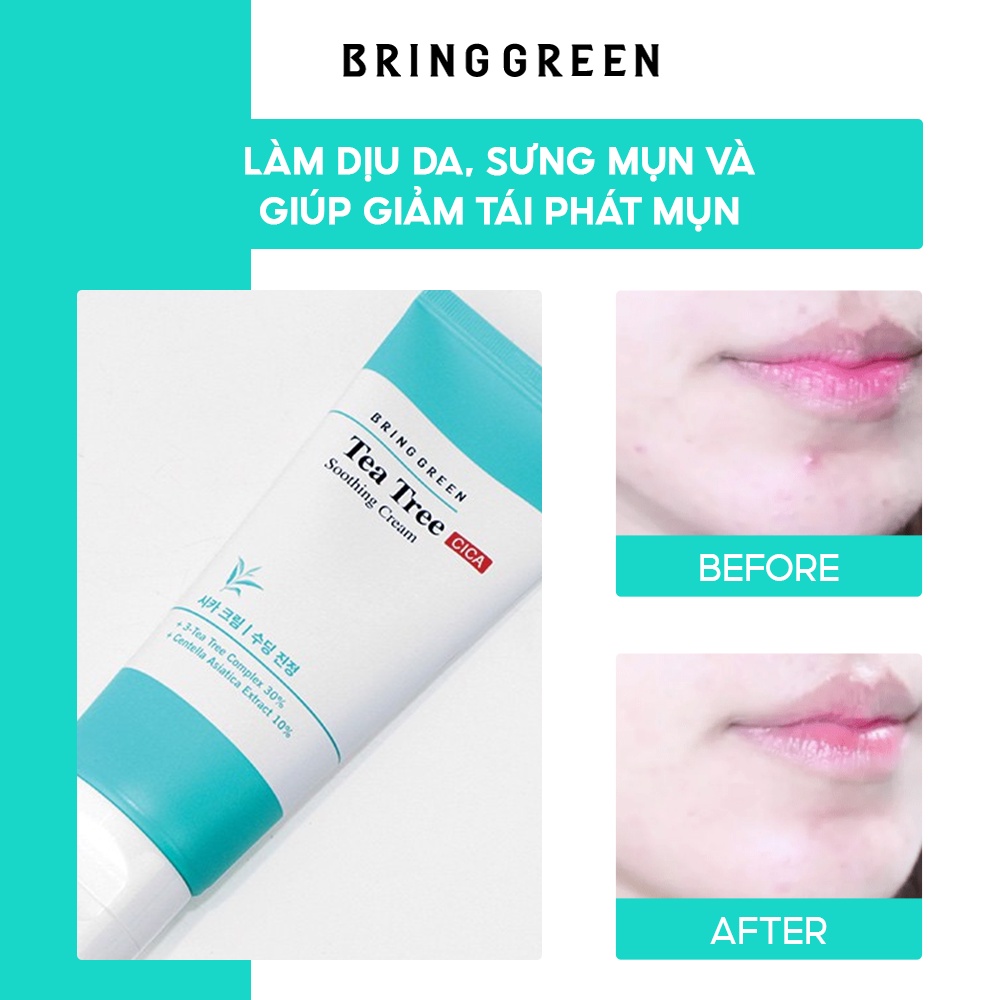 Kem Dưỡng Giảm Mụn Làm Dịu Da Tràm Trà Bring Green Tea Tree Cica Soothing Cream 100ml