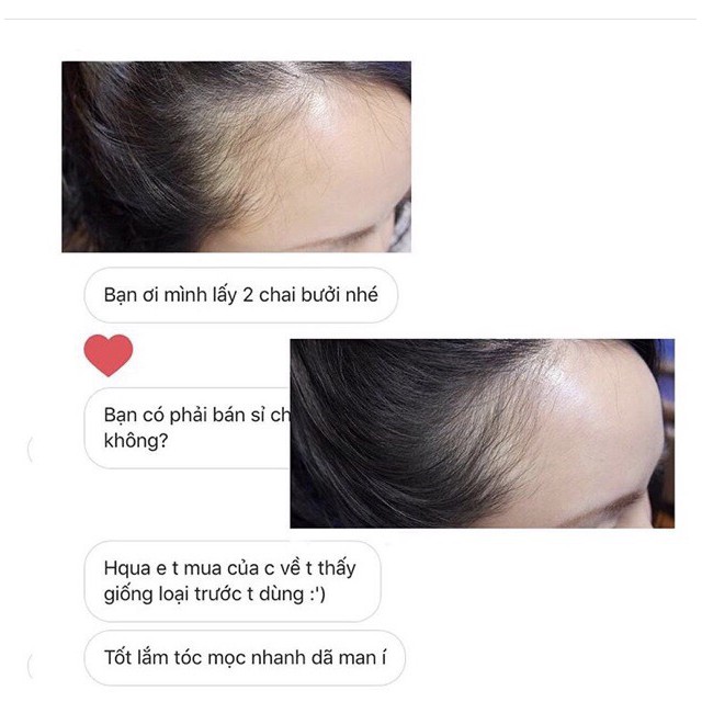 Tinh dầu bưởi kích thích mọc tóc dạng xịt | BigBuy360 - bigbuy360.vn