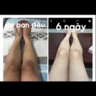 Tắm Trắng Châu Phi - Siêu Trắng