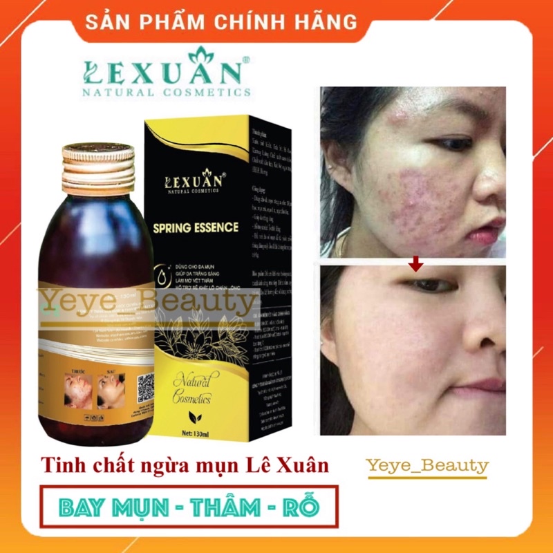 Ngừa mụn Lê Xuân🍀thảo dược đông y lê xuân🍀loại bỏ mụn trứng cá, mụn ẩn, mụn viêm,… | BigBuy360 - bigbuy360.vn