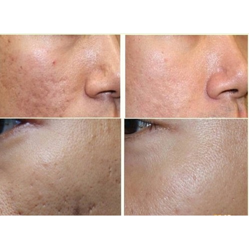 CAM KẾT CHÍNH HÃNG_Kem Sẹo Scar Esthetique 10g từ Mỹ | BigBuy360 - bigbuy360.vn