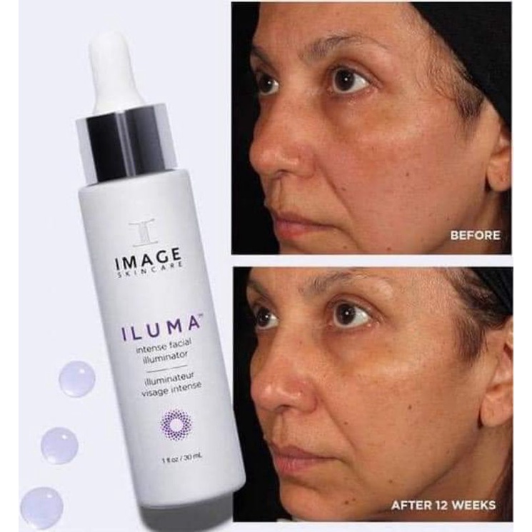Serum Image Iluma Intense mờ nám trắng da, mờ tàn nhang.Cải thiện đàn hồi da.😍🥰💋 Siêu phẩm tác động 