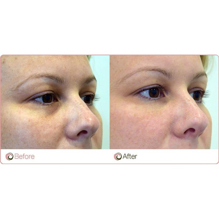 The Ordinary. Caffeine Solution 5% + EGCG Serum Mắt Làm Sáng Da Mắt Giảm Thâm Bọng Mắt Chống Lão Hóa Anti-Aging Eye Seru