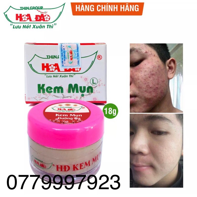 Kem mụn dưỡng da Hoa Đào Thingroup chính hãng 8g - 18g tặng kèm mặt nạ